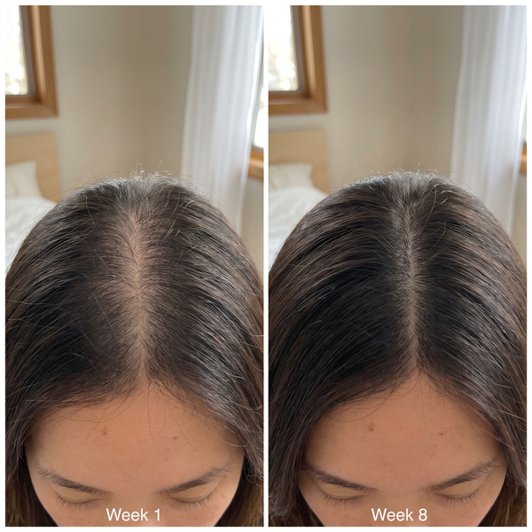 GROW:TURN AMPOULE | Korean Scalp & Hair Serum