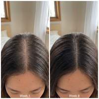 GROW:TURN AMPOULE | Korean Scalp & Hair Serum
